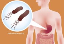 Seis de cada 10 mexicanos portan bacteria relacionada con gastritis y cáncer