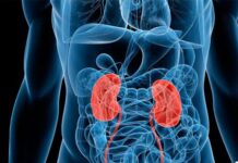 La insuficiencia renal es una enfermedad catastrófica en México